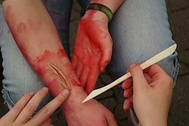 DRK Mülheim JRK Armverletzung